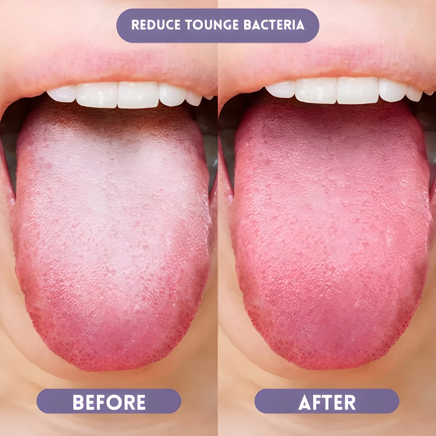 Probiotic Oral Spray