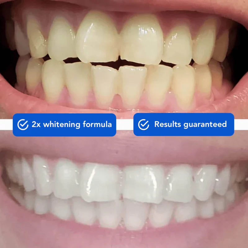 Teeth Whitening Powder